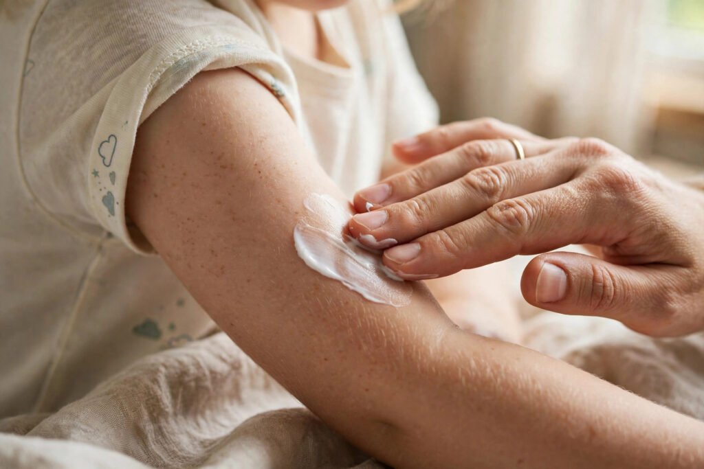 keratosis pilaris in kids